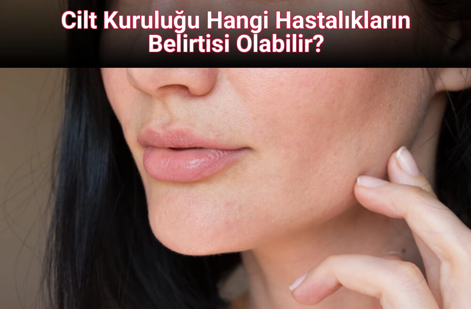 Cilt Kuruluğu Hangi Hastalıkların Belirtisi Olabilir?