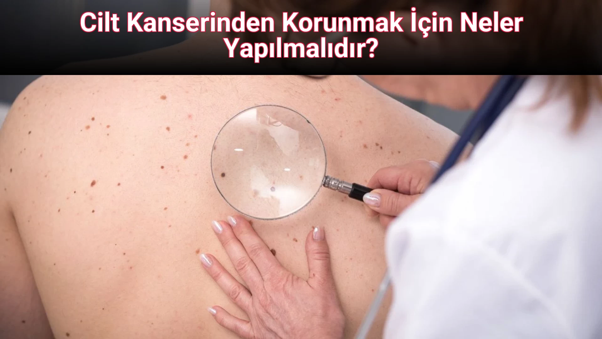 Cilt Kanserinden Korunmak İçin Neler Yapılmalıdır?