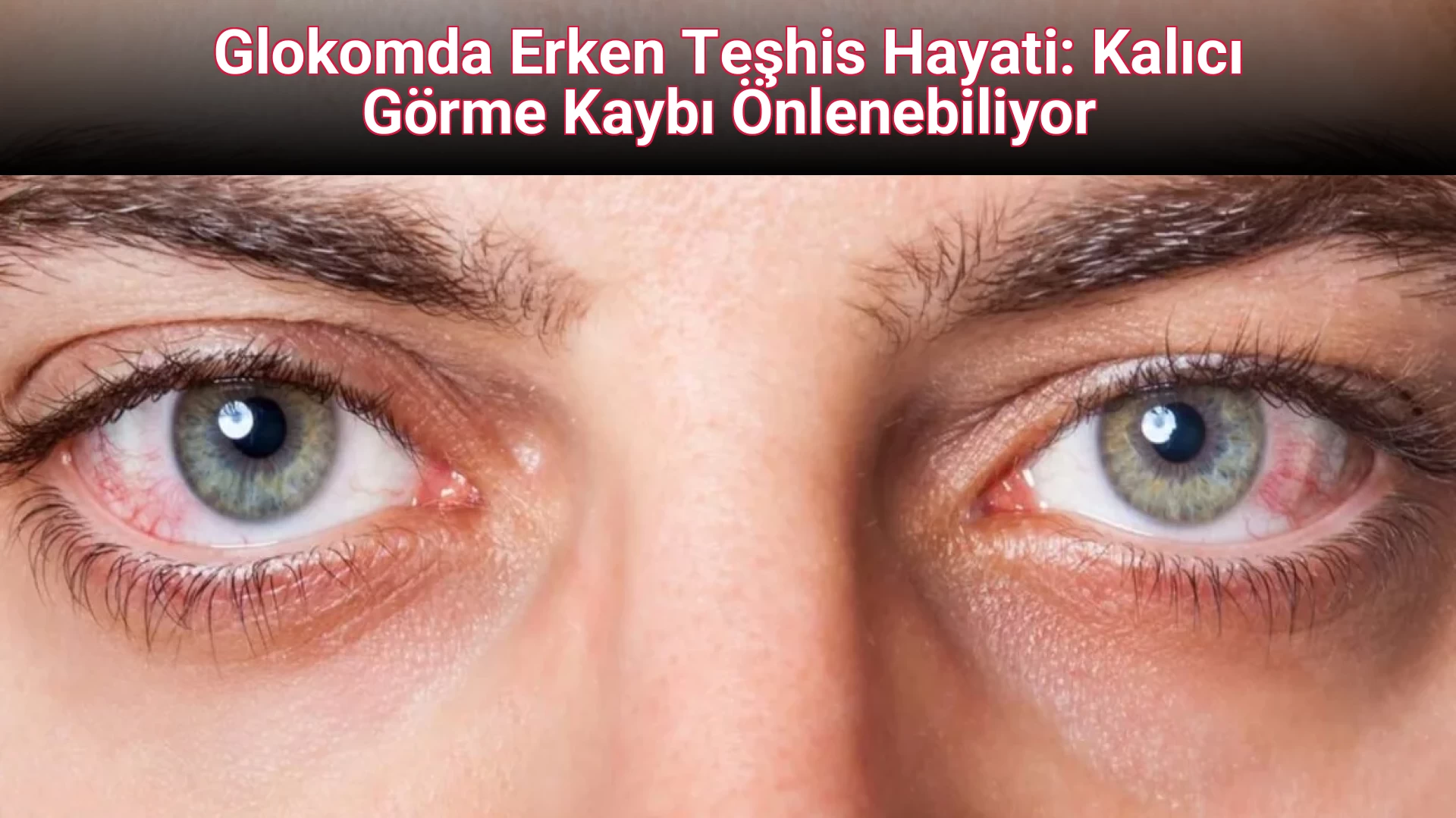 Glokomda Erken Teşhis Hayati: Kalıcı Görme Kaybı Önlenebiliyor