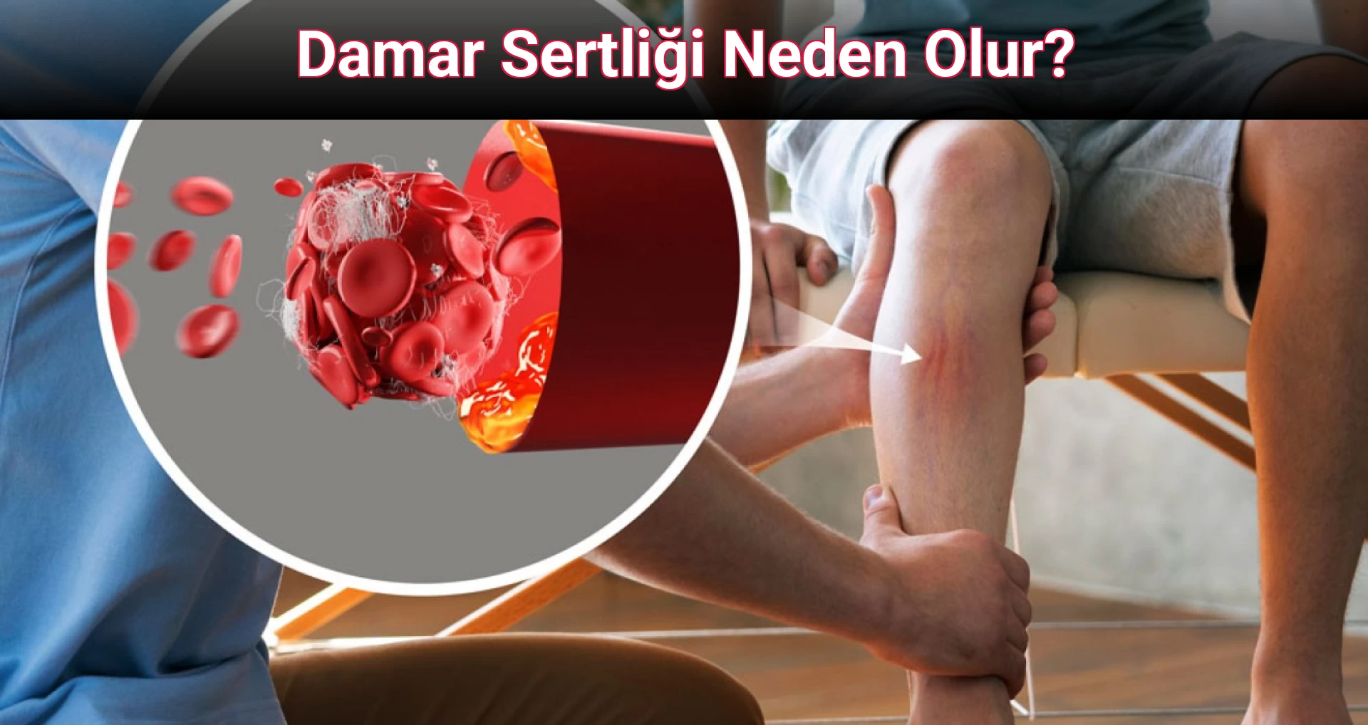Damar Sertliği Neden Olur?
