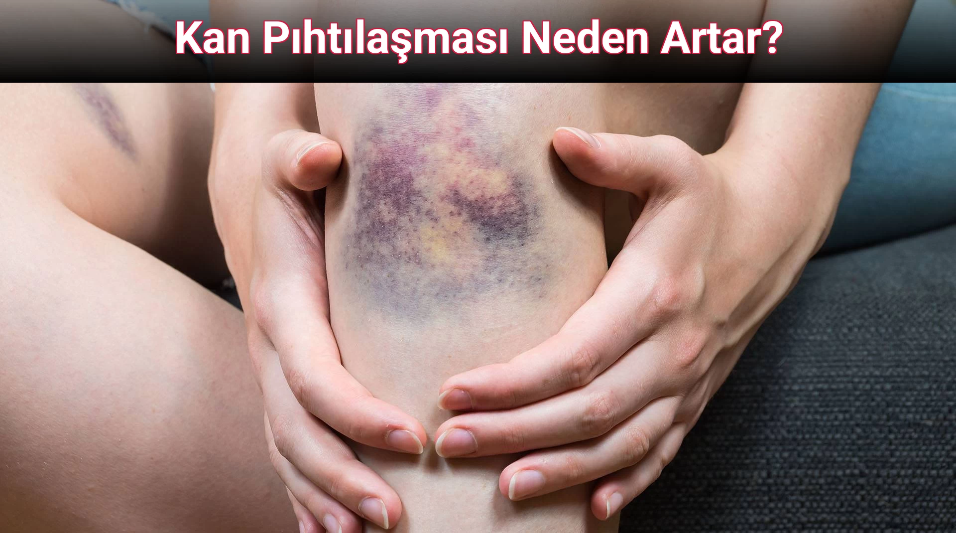 Kan Pıhtılaşması Neden Artar?