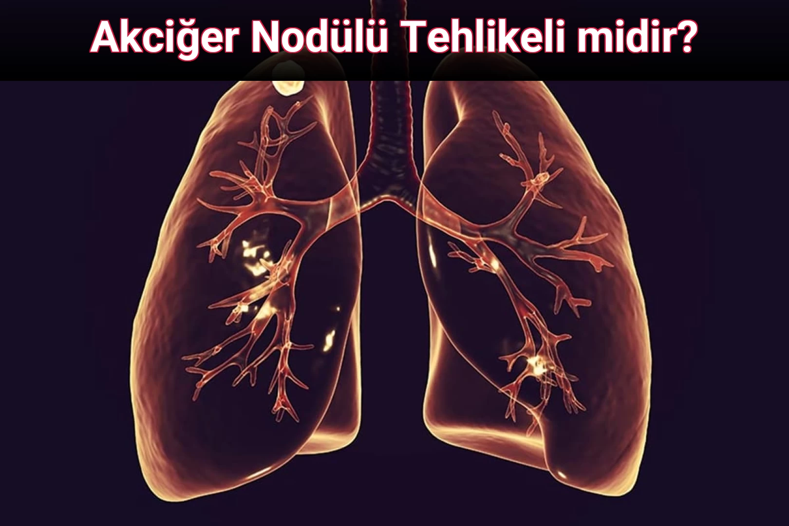 Akciğer Nodülü Tehlikeli midir?