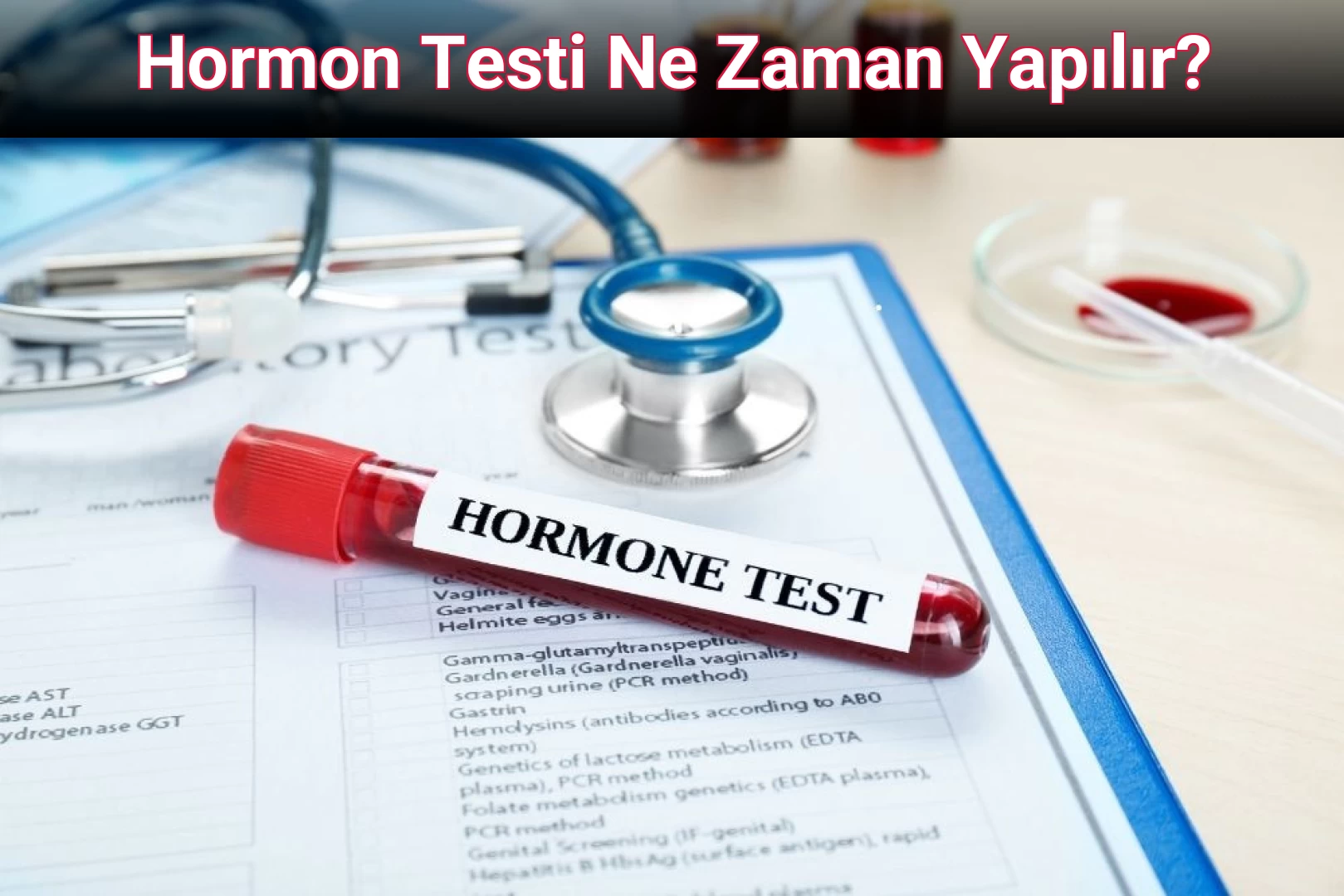 Hormon Testi Ne Zaman Yapılır?