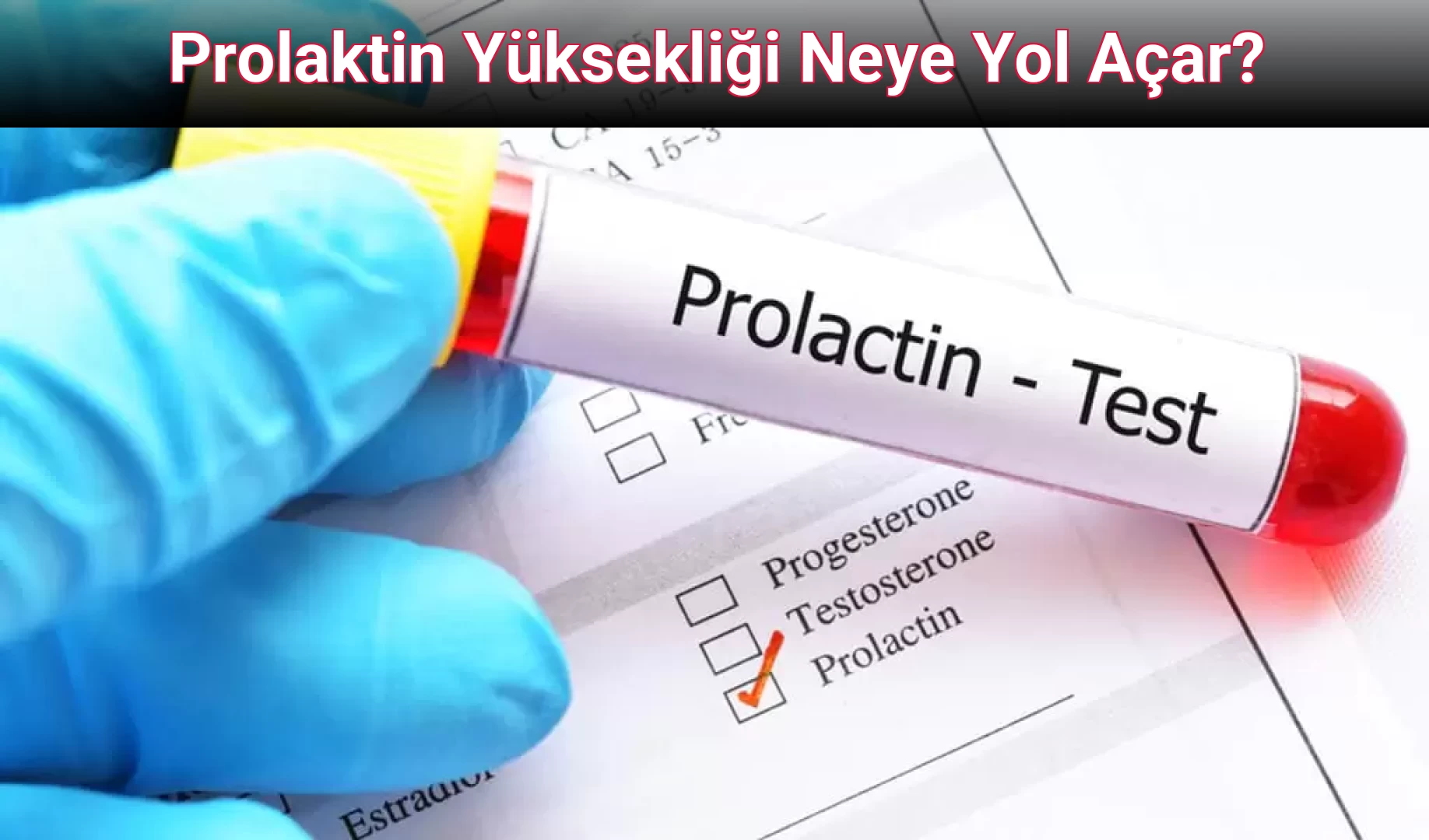 Prolaktin Yüksekliği Neye Yol Açar?