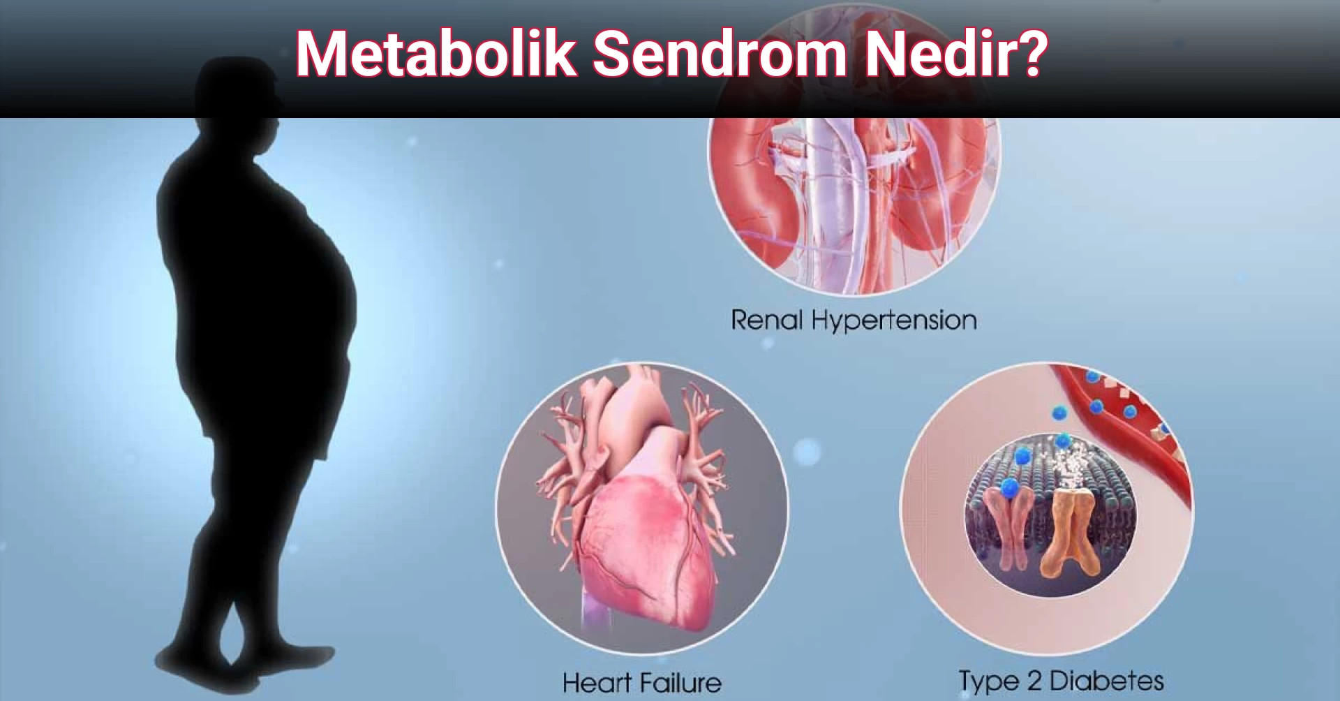 Metabolik Sendrom Nedir?