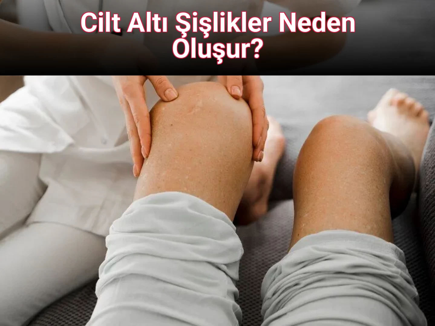 Cilt Altı Şişlikler Neden Oluşur?