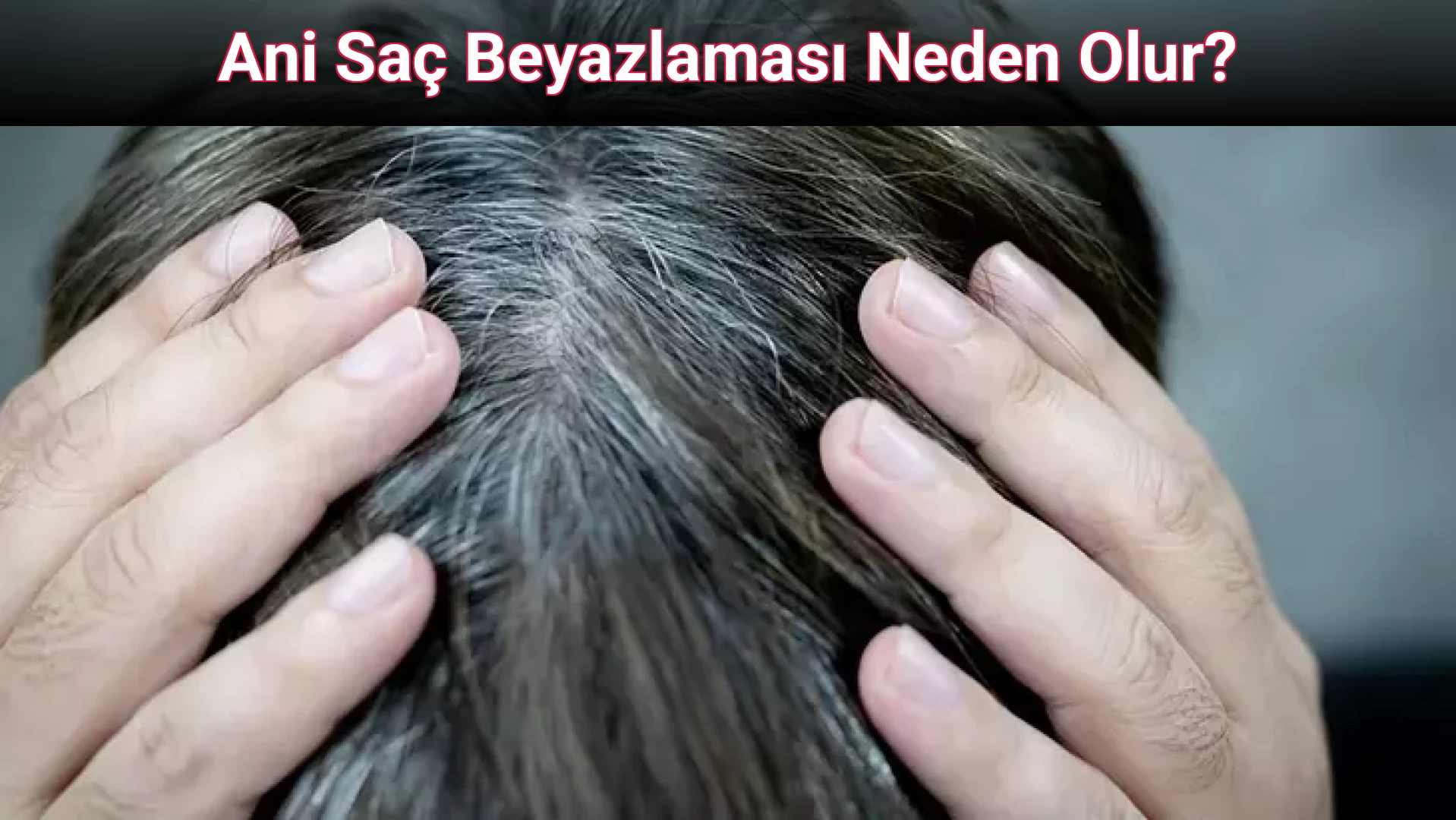 Ani Saç Beyazlaması Neden Olur?