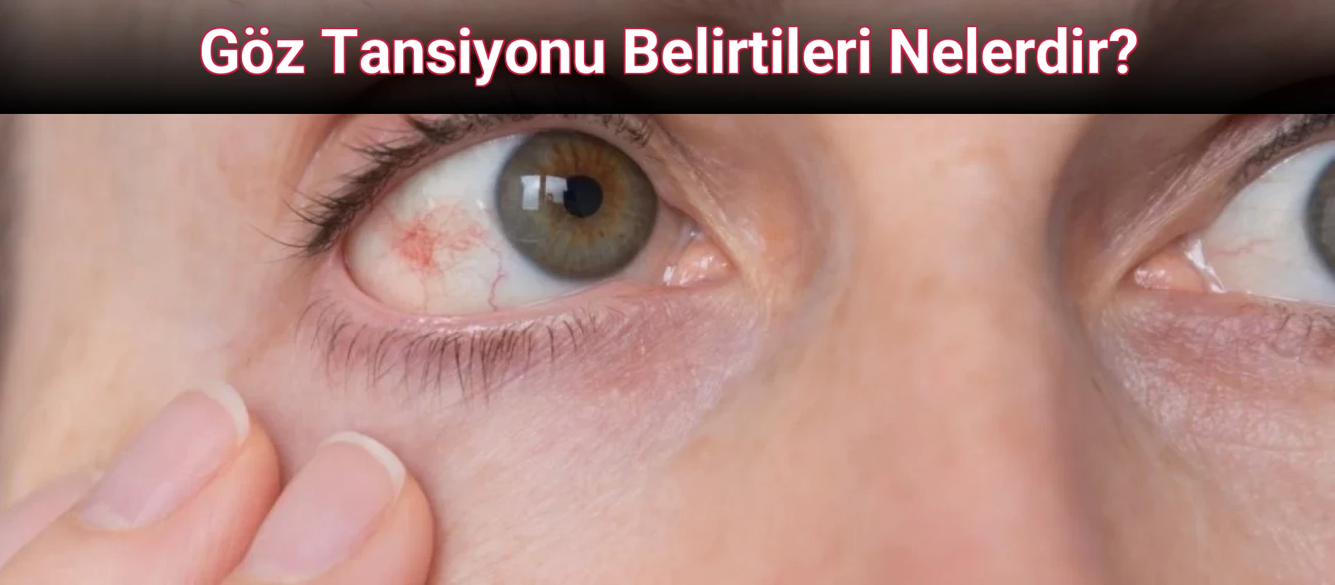 Göz Tansiyonu Belirtileri Nelerdir?