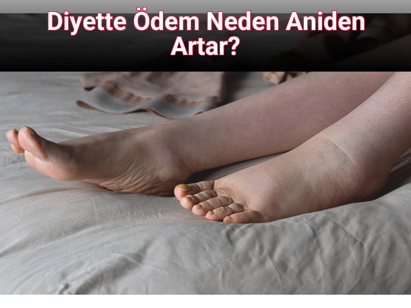 Diyette Ödem Neden Aniden Artar?