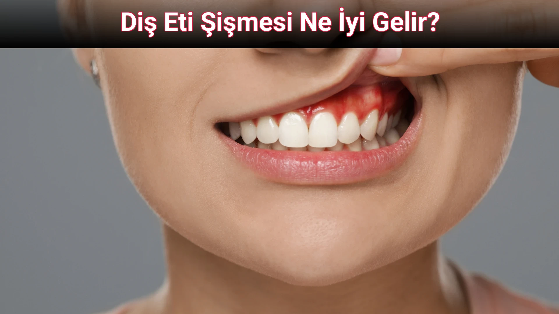 Diş Eti Şişmesi Ne İyi Gelir?