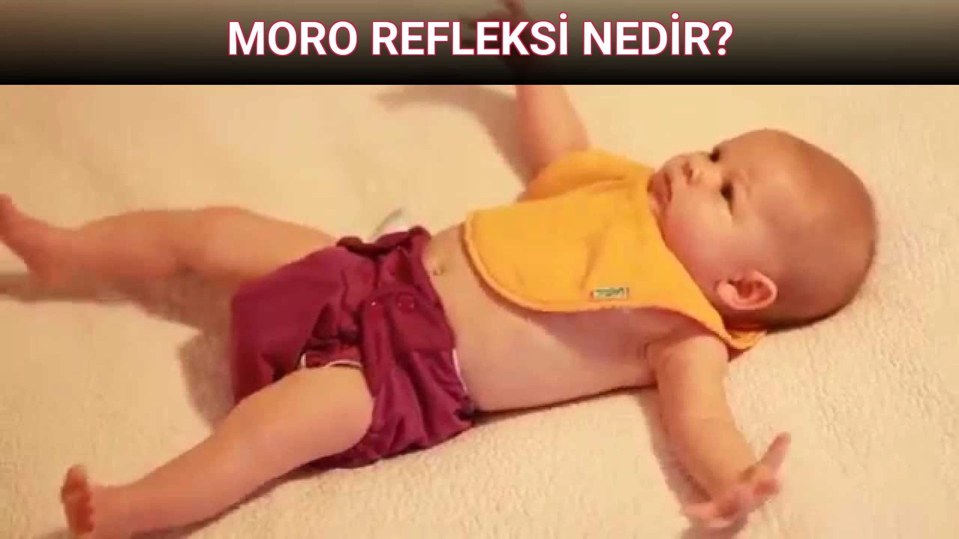 MORO REFLEKSİ NEDİR?