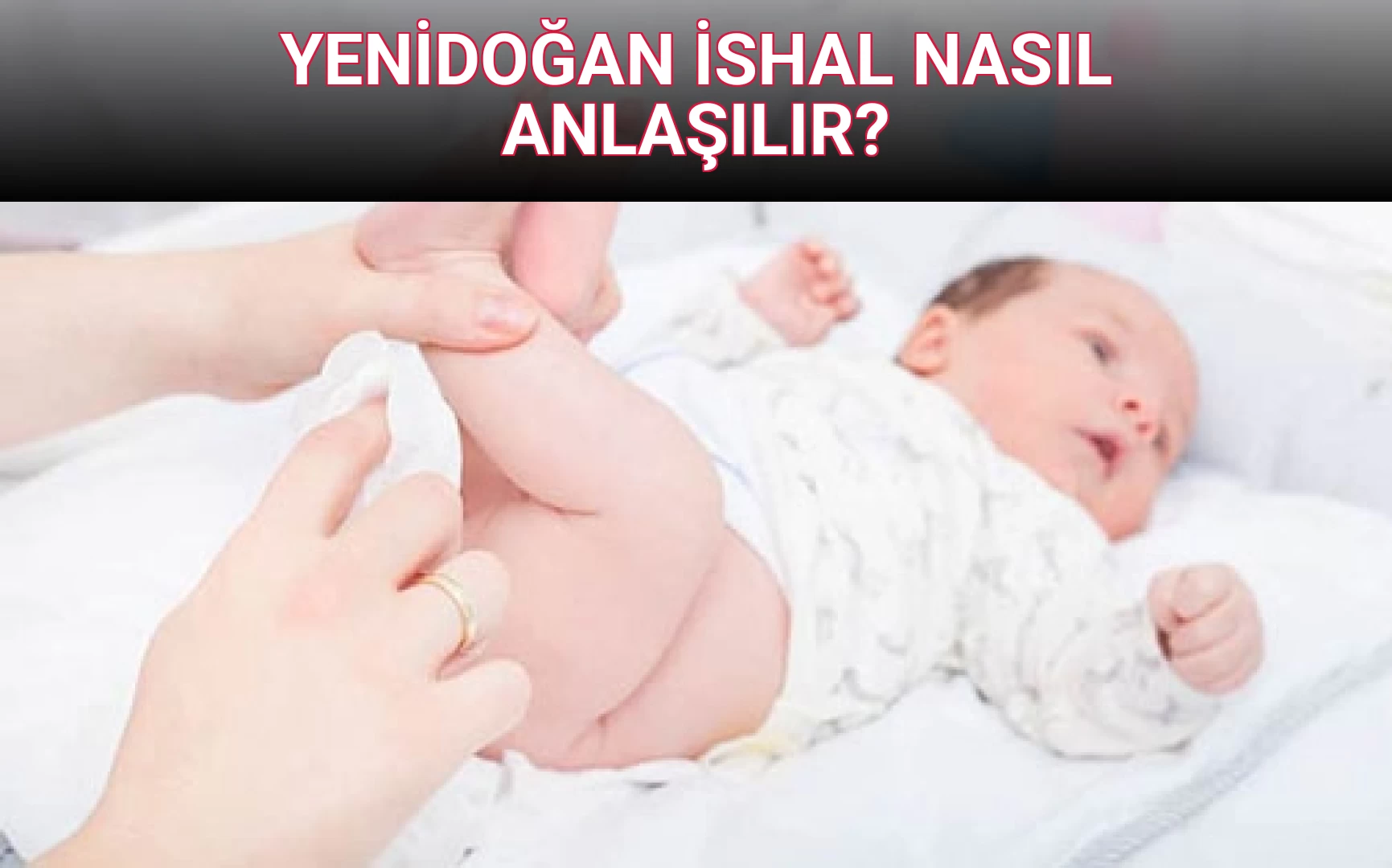 YENİDOĞAN İSHAL NASIL ANLAŞILIR?