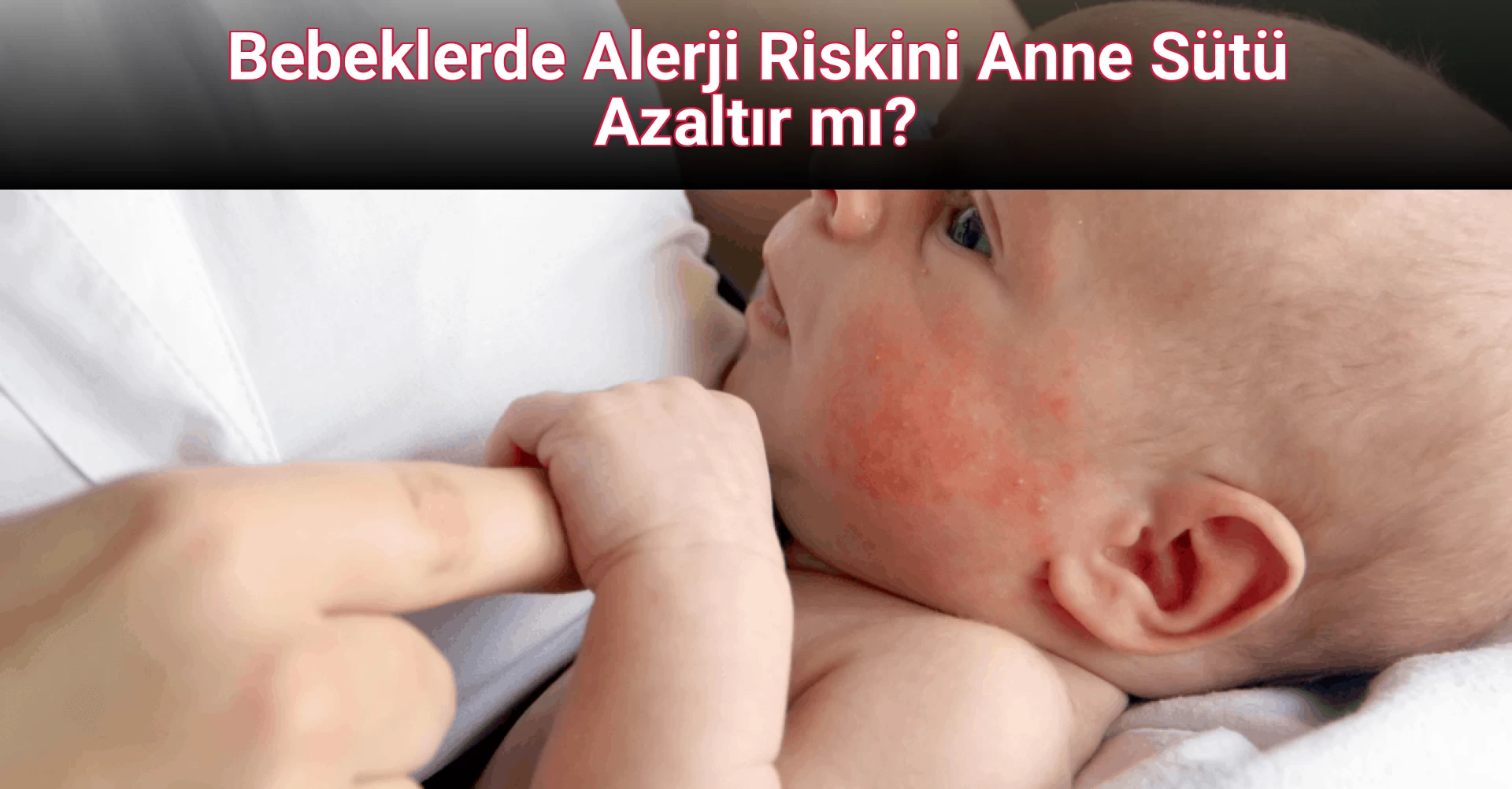 Bebeklerde Alerji Riskini Anne Sütü Azaltır mı?