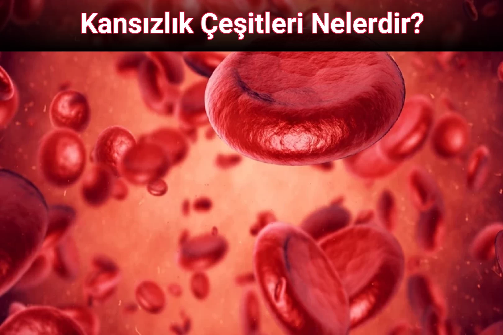 Kansızlık Çeşitleri Nelerdir?